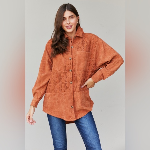 Button-Up Spliced Lace Shacket - Picture 1 of 8